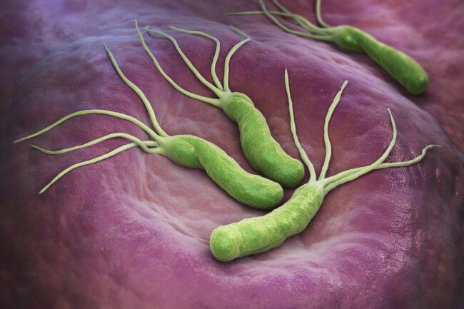 Helicobacter pylori Gastroenterologie