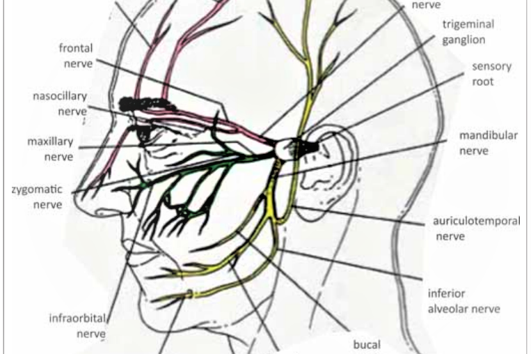 Nevralgia trigeminala