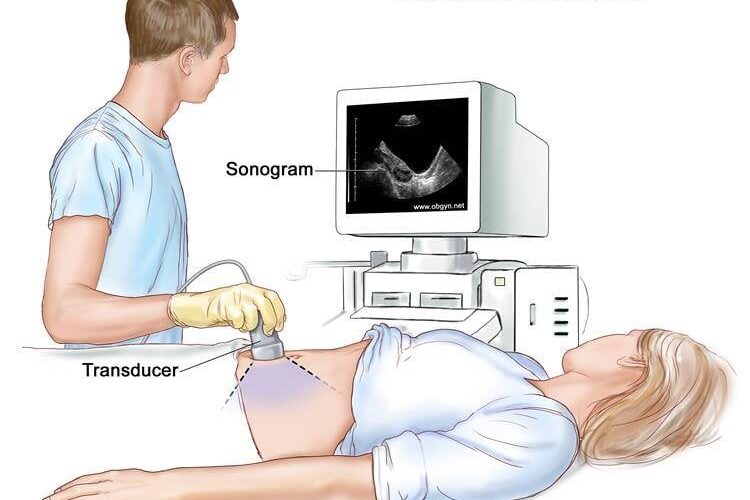 ECOGRAFIE ABDOMINALA
