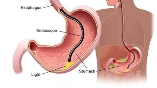 SFATURI PRACTICE inaintea unei GASTROSCOPII Gastroenterologie