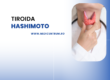 tiroida hashimoto