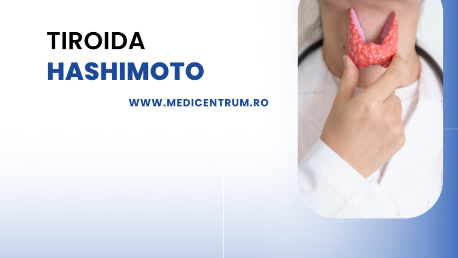 tiroida hashimoto tiroida hashimoto